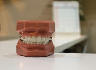 What You Need to Know About Your Wisdom Teeth
